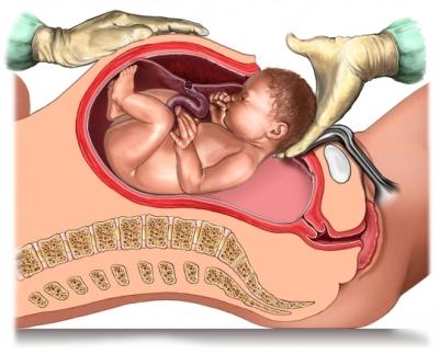 c-section-graphic